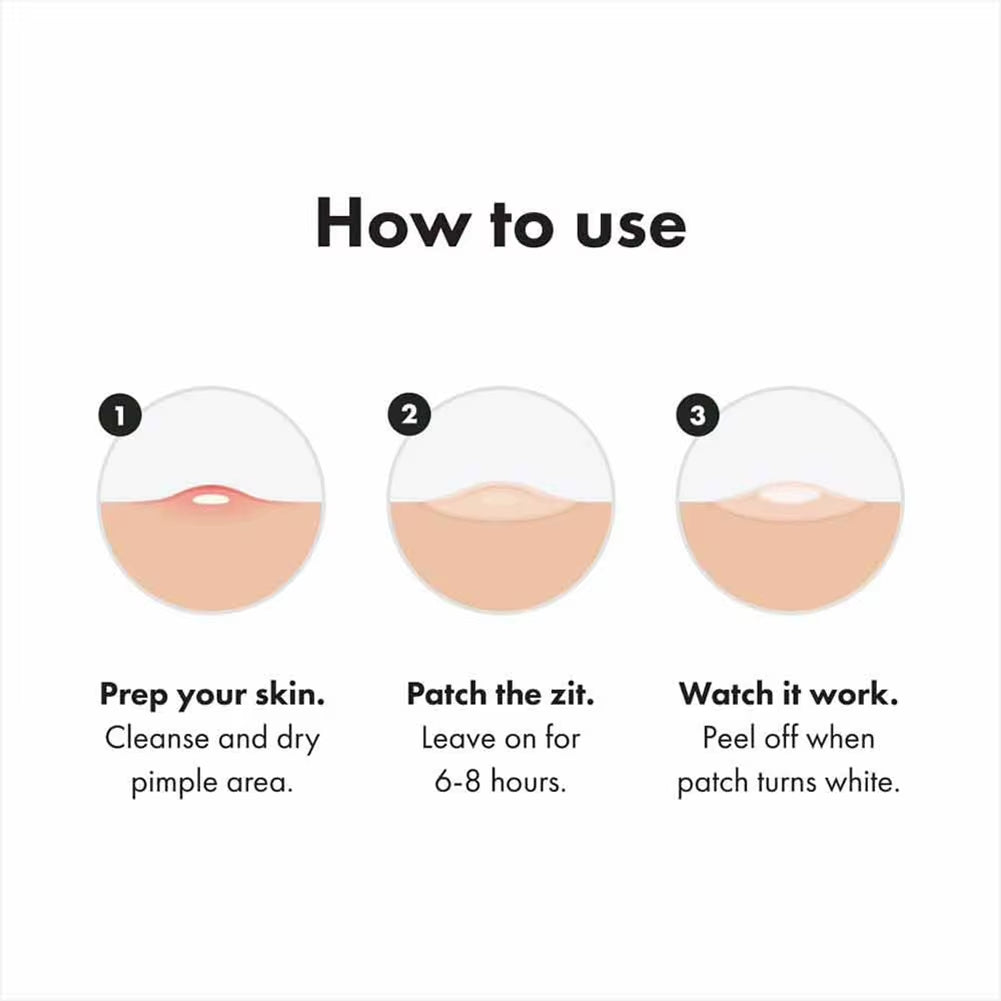 Hydrogel Acne Patch Invisible Closed Mouth Invisible Acne Face Invisible Waterproof and Breathable Skin Patch Skin Care Tools